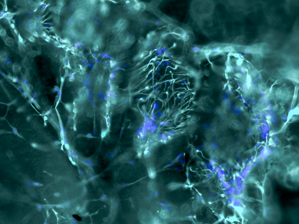 Tessara Therapeutics